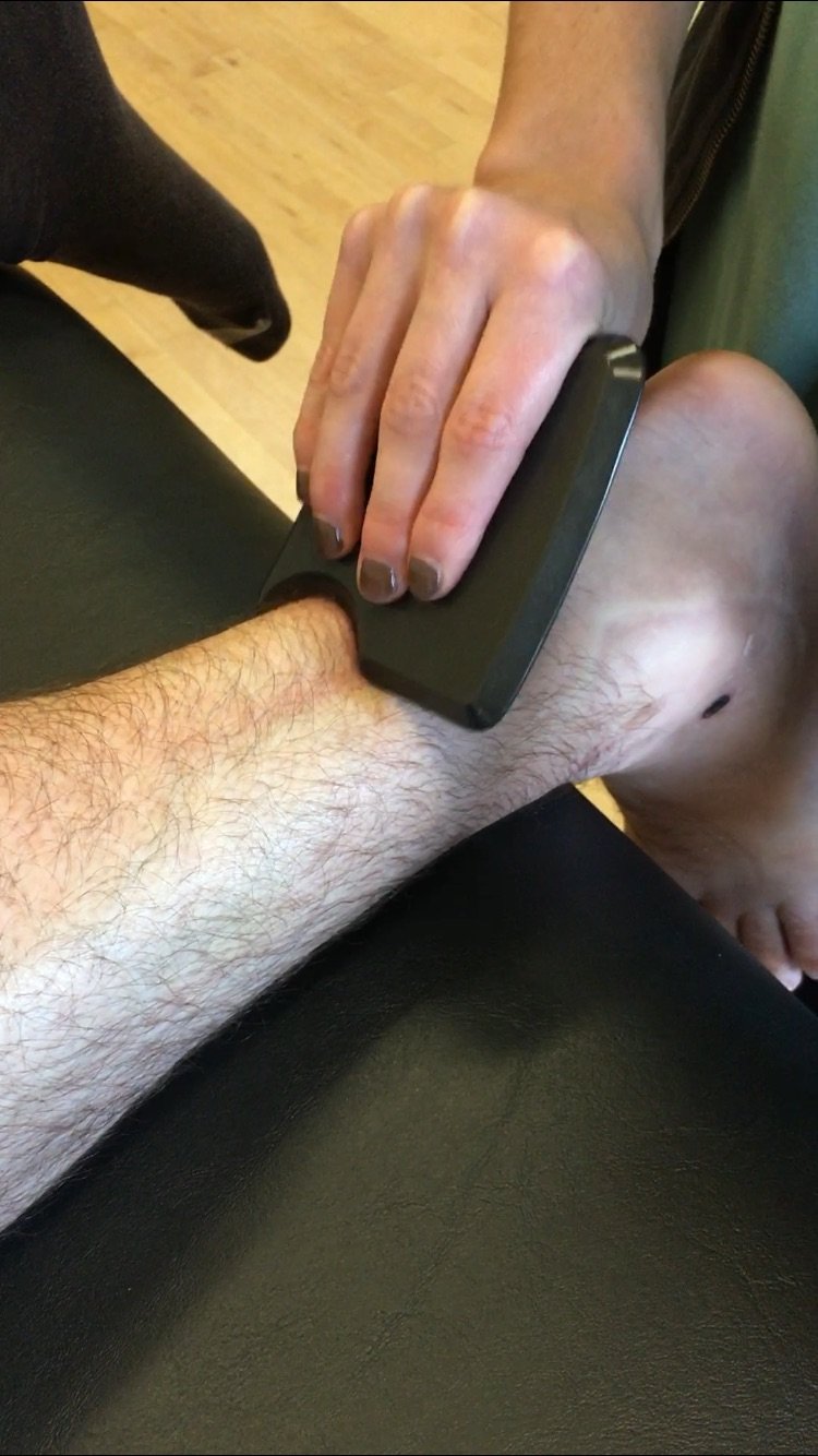 Instrument Assisted Soft Tissue Mobilization Birmingham Physical