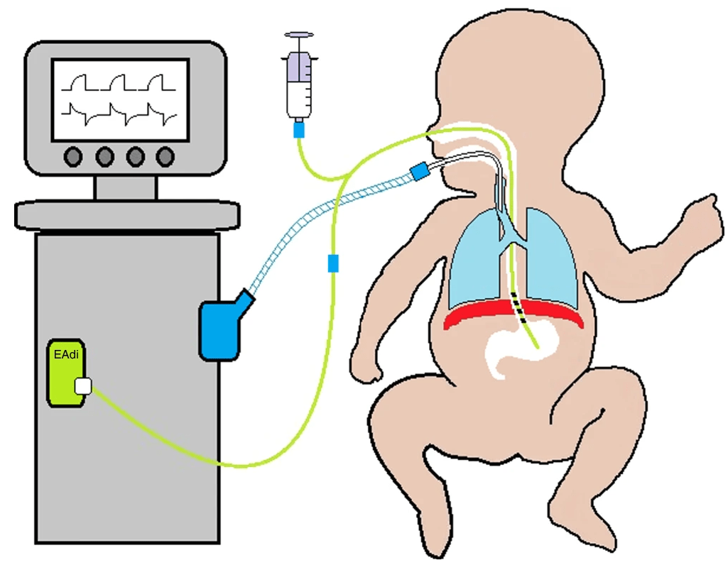 Resuscitation — Birth documentation