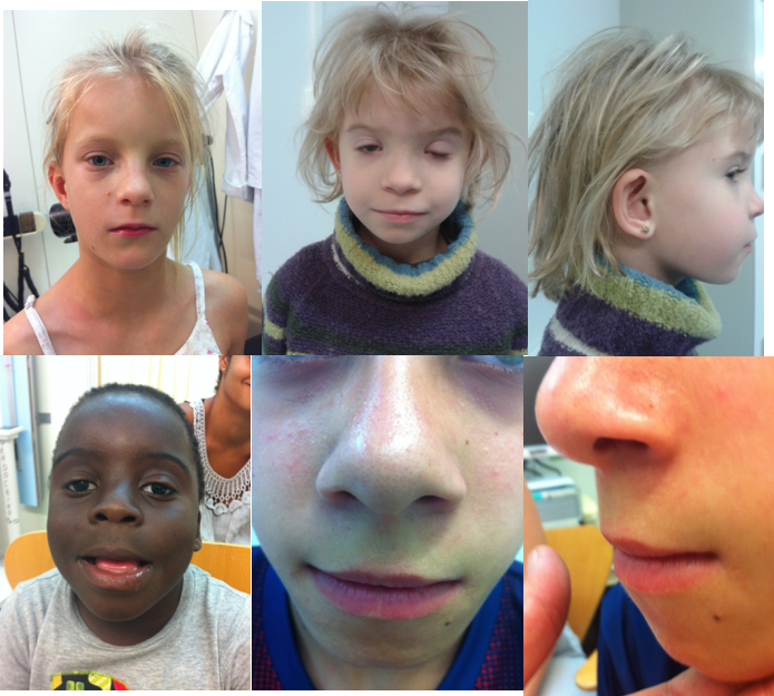 Normal Railroad Track Ears Goimages Talk