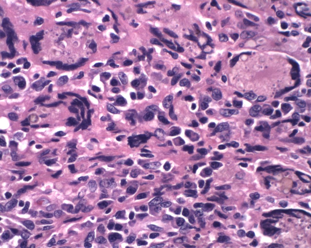 AUTOPSY ASSISTANT JOBS AUTOPSY ASSISTANT JOBS