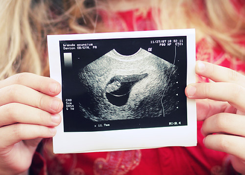 4 WEEK PREGNANCY SYMPTOMS PREGNANCY SYMPTOMS