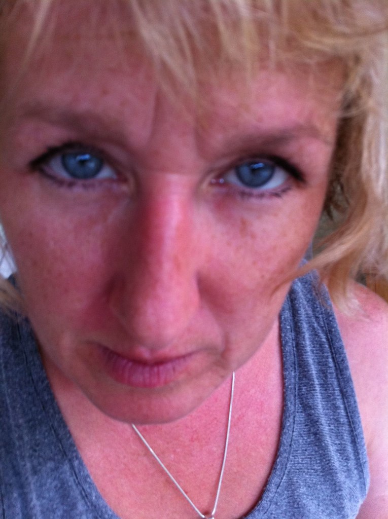 SINUS INFECTION SYMPTOMS DIZZINESS SYMPTOMS DIZZINESS