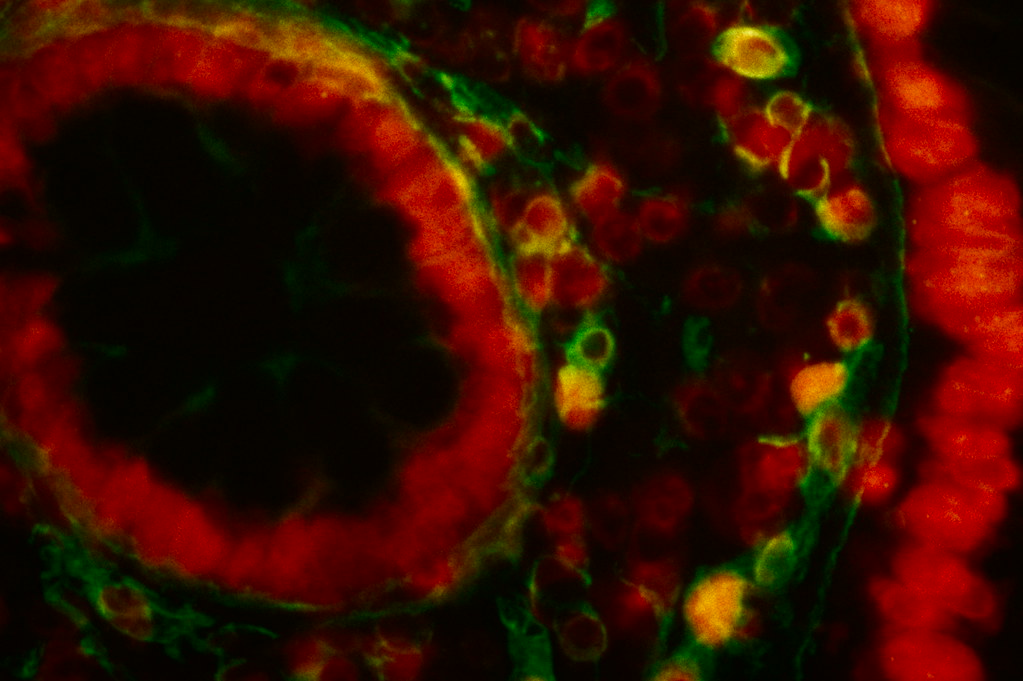 COLLAGEN RED LIGHT THERAPY REVIEWS COLLAGEN RED LIGHT THERAPY REVIEWS