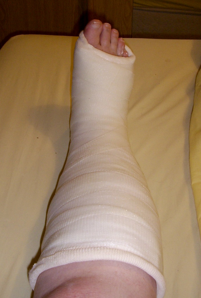 PLASTER CAST COVER PLASTER CAST COVER