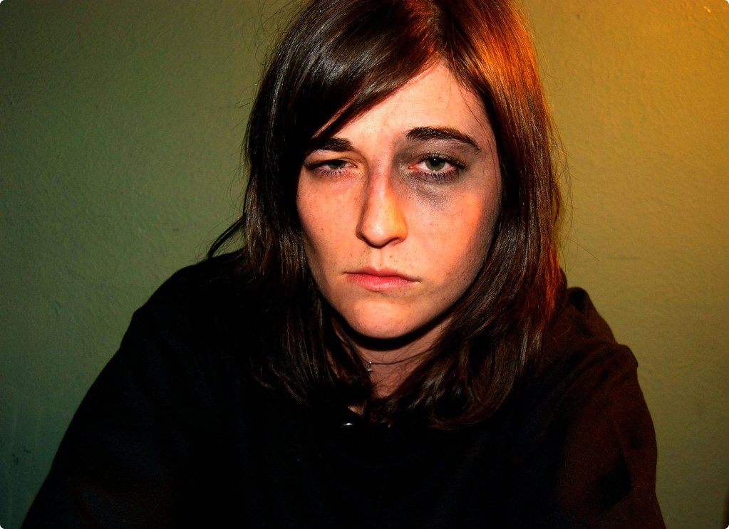 CONTACT LENSE STUCK TO EYE STUCK TO EYE CONTACT LENS INFECTION TREATMENT