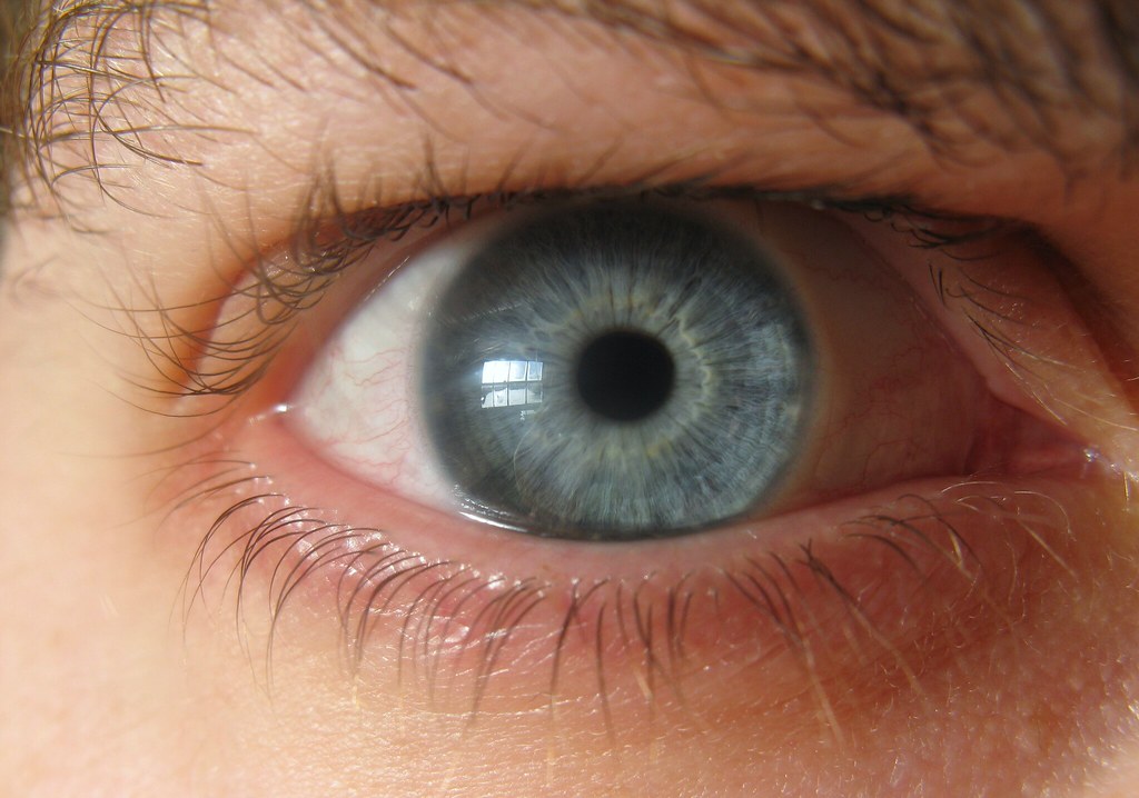 BIFOCAL SOFT CONTACT LENS. BIFOCAL SOFT BIFOCAL SOFT CONTACT LENS