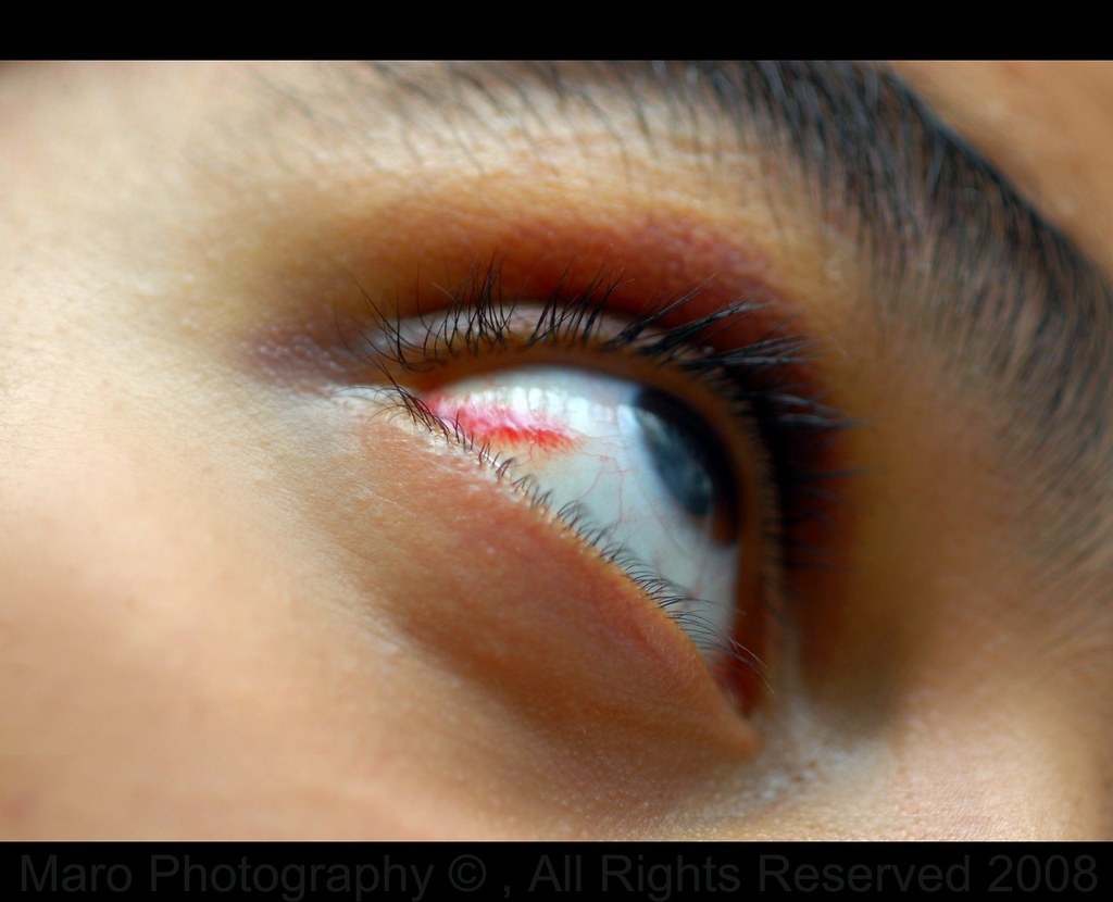 CONTACT LENS RED EYE CONTACT LENS BOSTON CONTACT LENSES