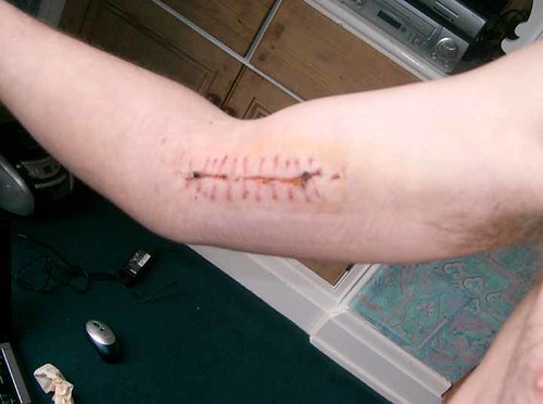 LOS ANGELES INJURY LAWYERS LOS ANGELES B FLAT MUSIC