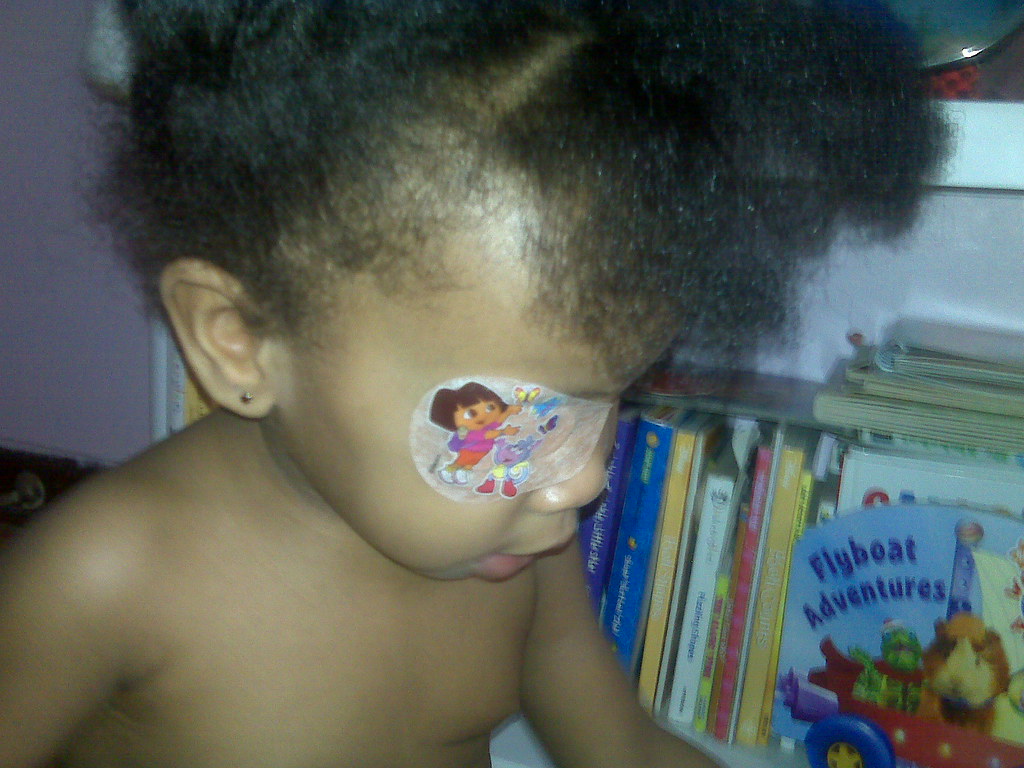 BABY DIAPER RASH PICTURES