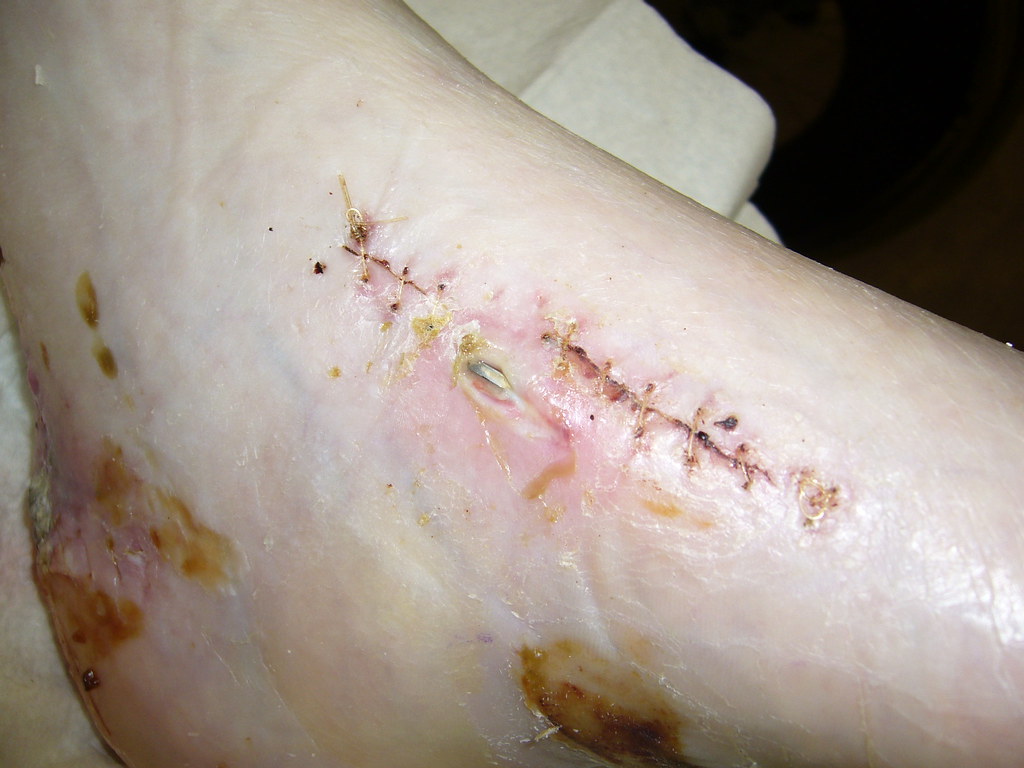 HARDWOOD FLOORING NAILER VS STAPLER HARDWOOD FLOORING