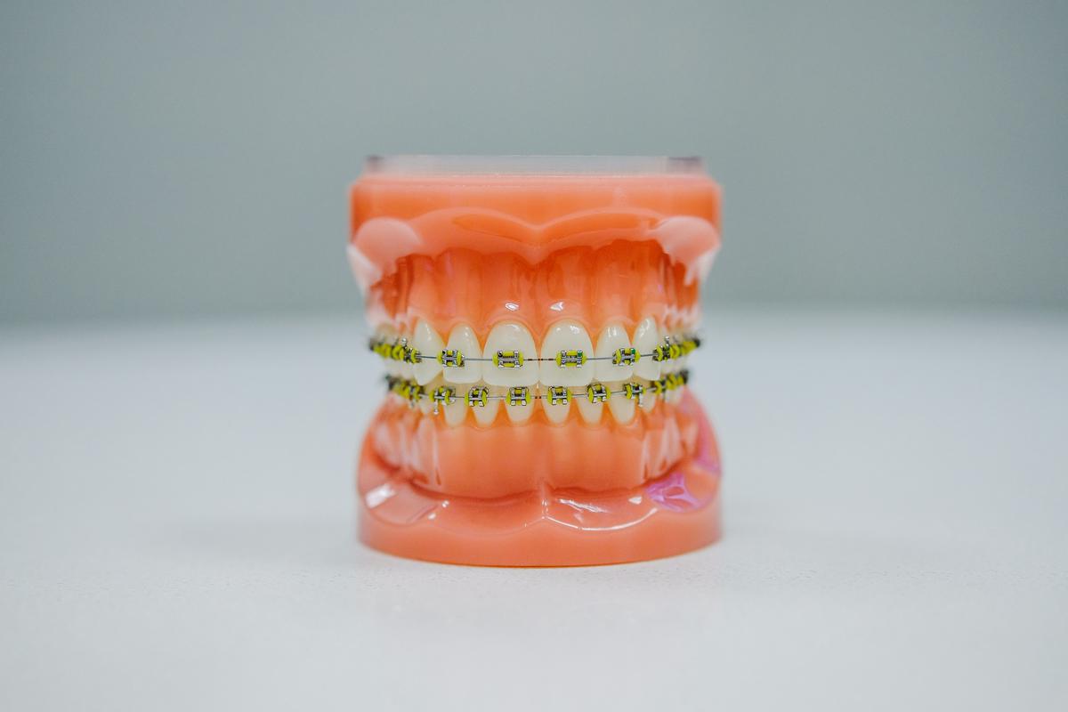 Dental vs Skeletal Underbite Bite Correction
