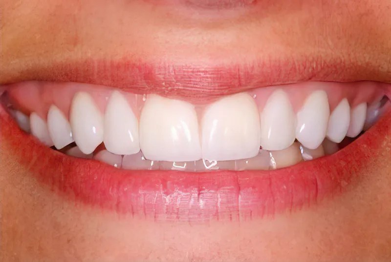 Mt Juliet Dentist Office Lebanon, TN Bivens Dentistry