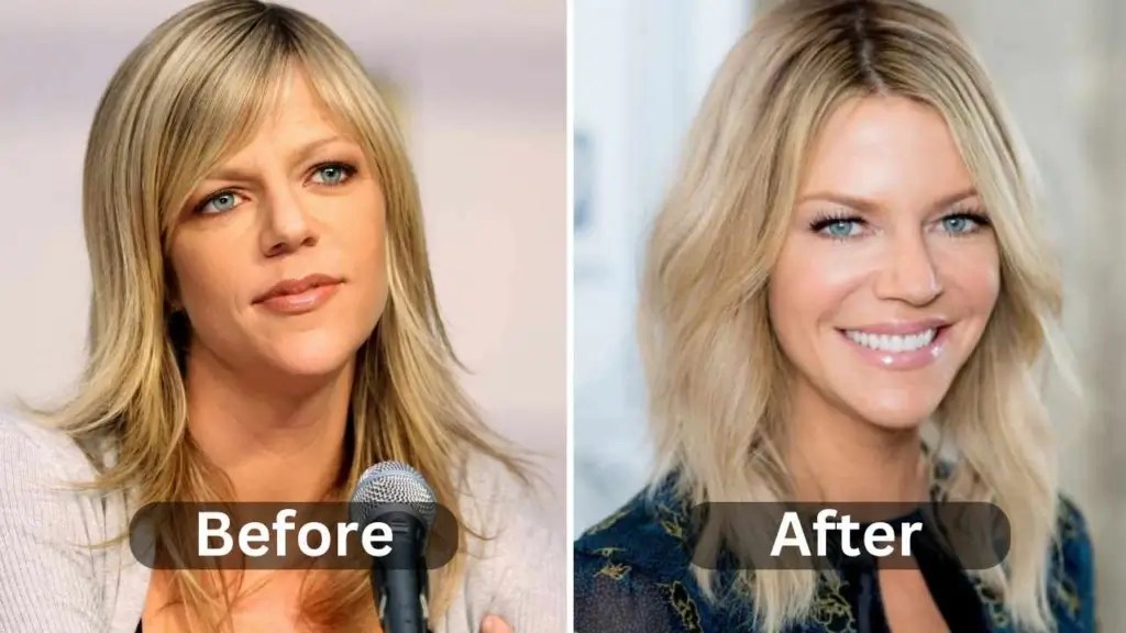 Kaitlin Olson's Plastic Surgery What You Need to Know Bizrahmed
