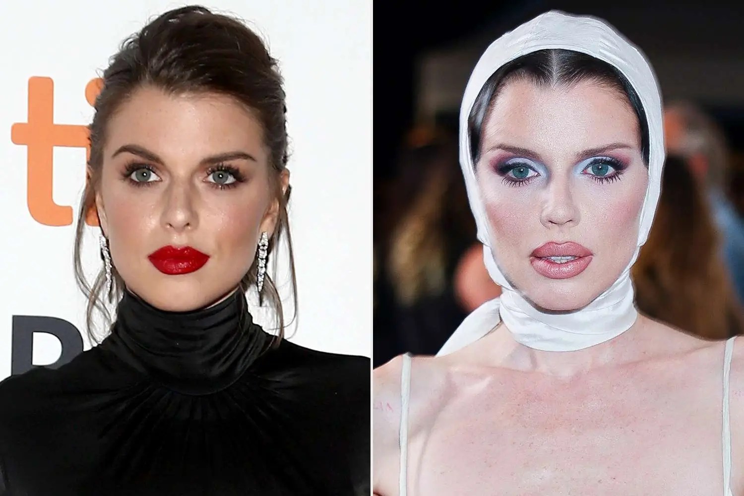 Michelle Pfeiffer and the Conversation Around Plastic Surgery Bizrahmed