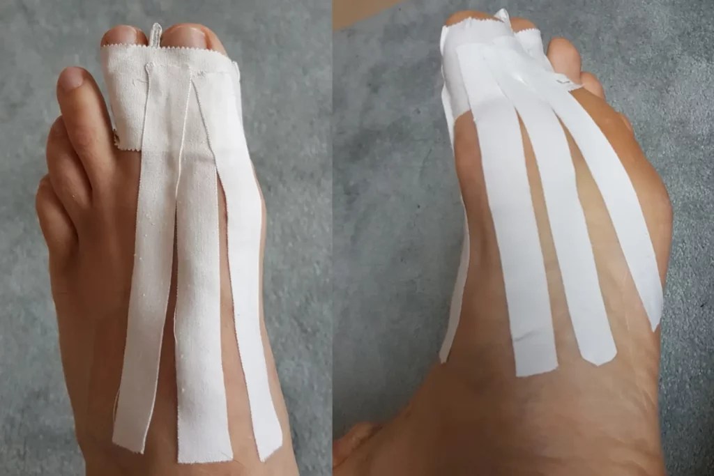 BJJ Turf Toe How to Tape, Treat and Prevent BJJ Toe Injuries