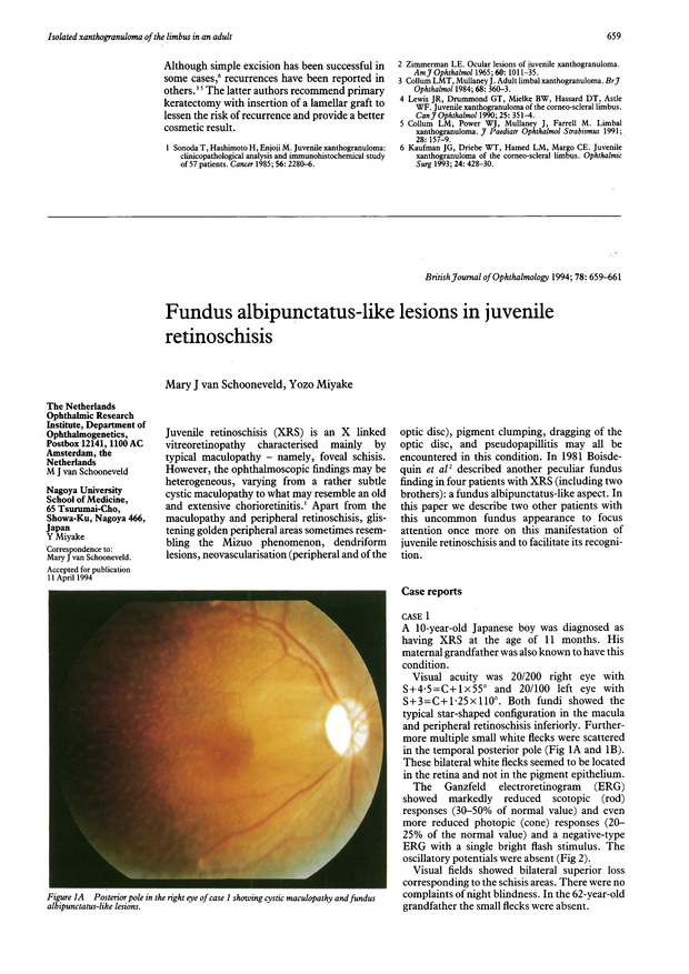 Fundus albipunctatuslike lesions in juvenile retinoschisis. British
