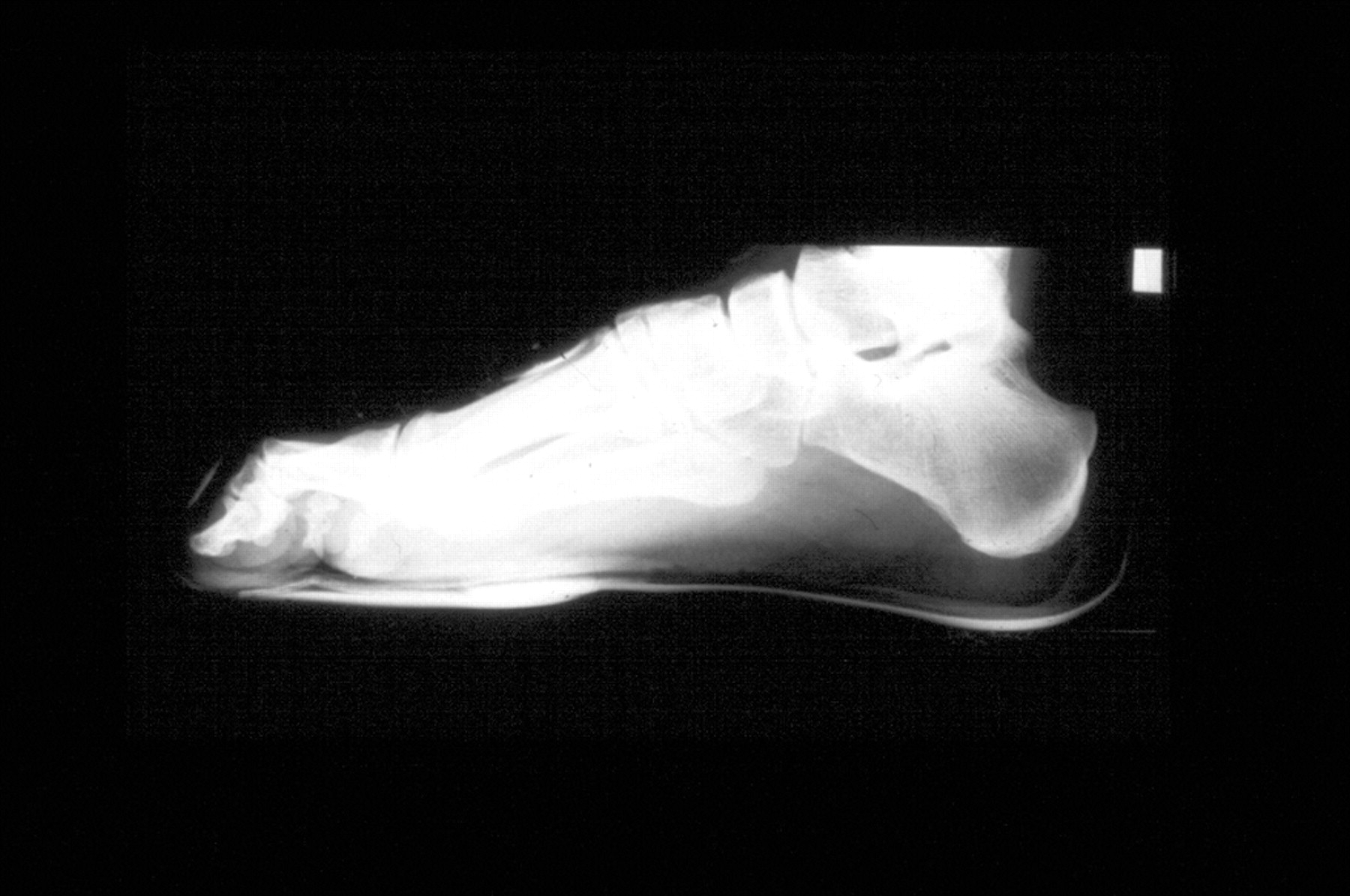 Physiological responses to rock climbing in young climbers Morrison