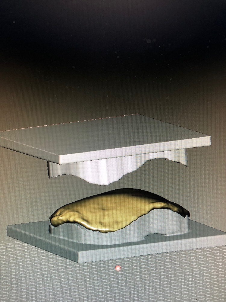 Help making a negative mold for Cranioplasty Modeling Blender