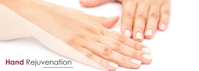 Hand Rejuvenation Treatment Blissful Me MeSpa