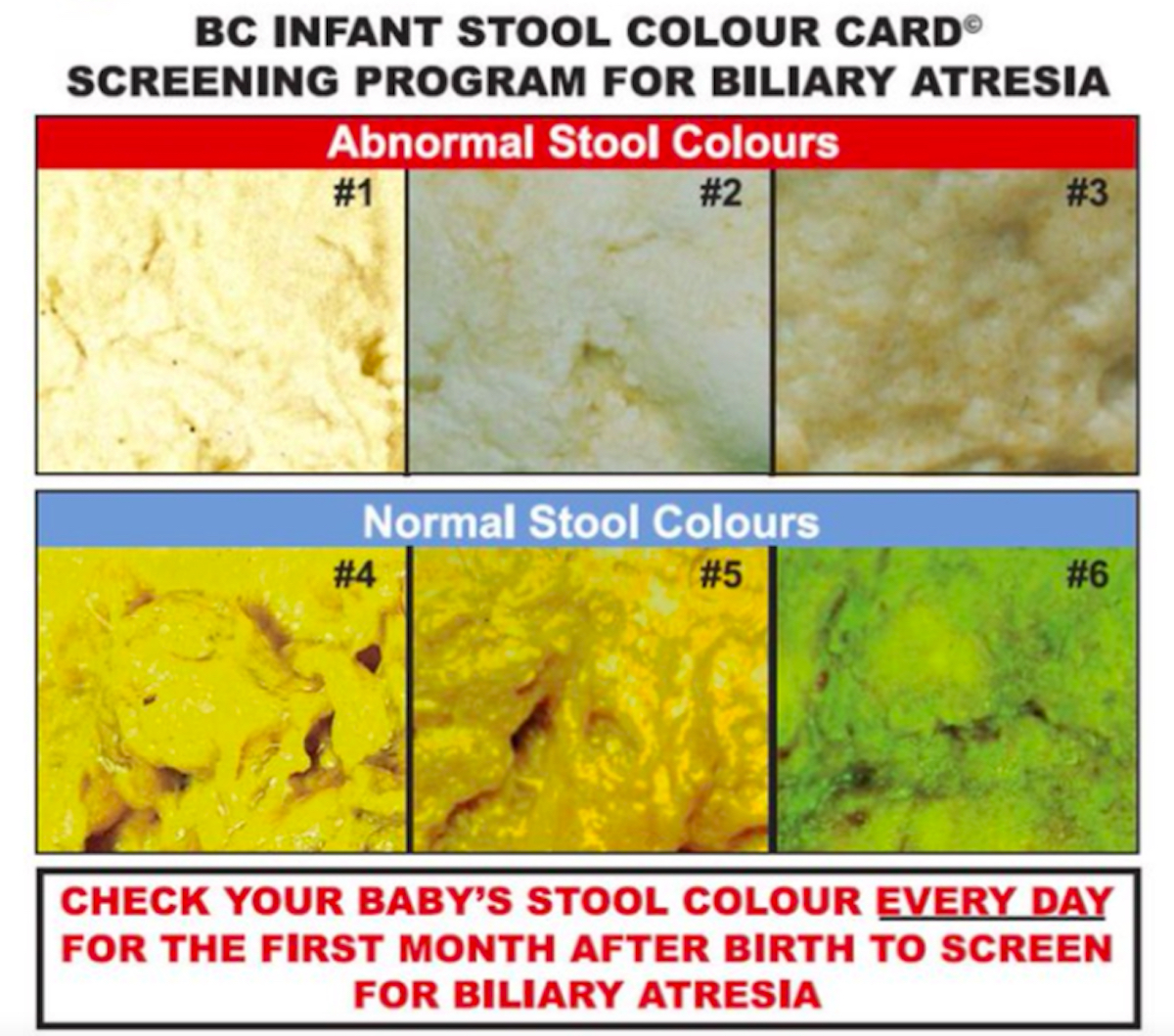 12 free printable stool color charts word pdf baby stools color chart