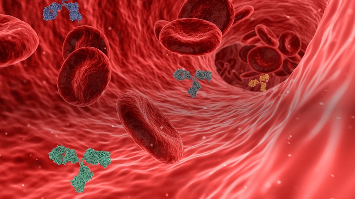 Neonatal Jaundice and G6PD Deficiency Pediatric Practice… Pearls for