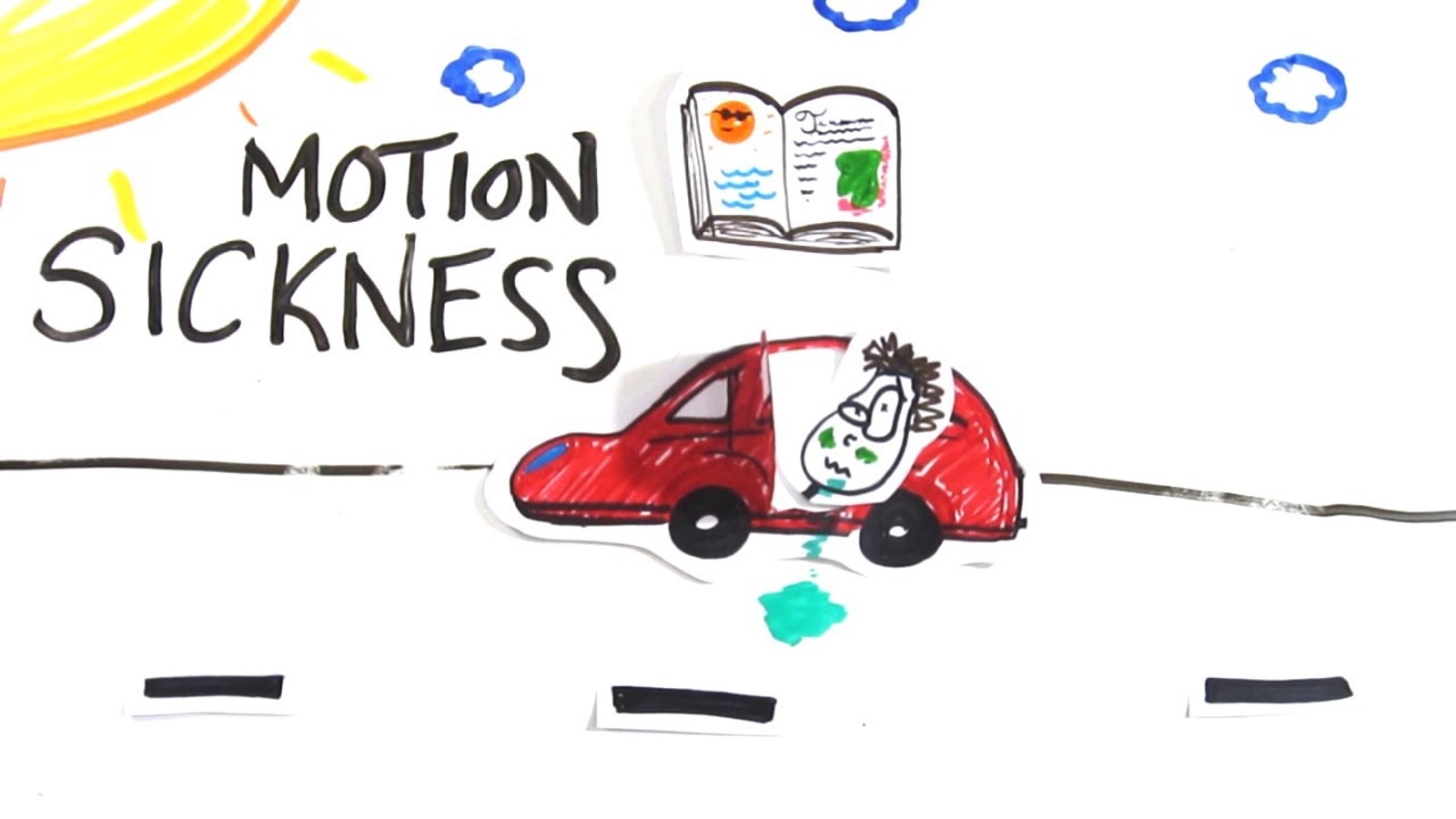 What is Motion Sickness Pediatric Practice… Pearls for your Pediatric