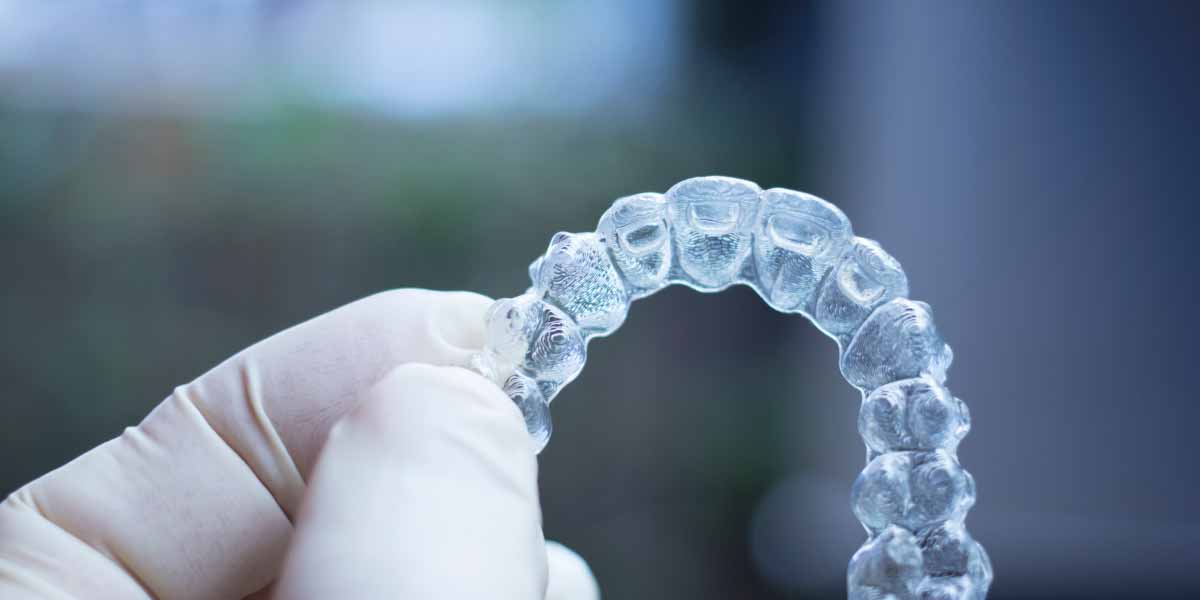 Illusion Aligners Blogs Your Guide to Clear Aligners Illusion Aligners