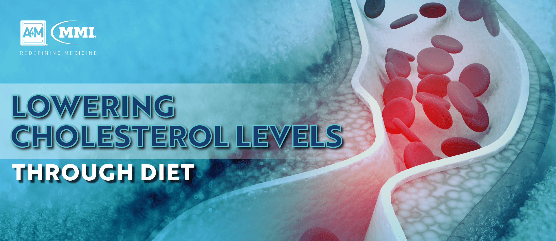 Lowering Cholesterol Levels Through Diet A4M Blog A4M Blog