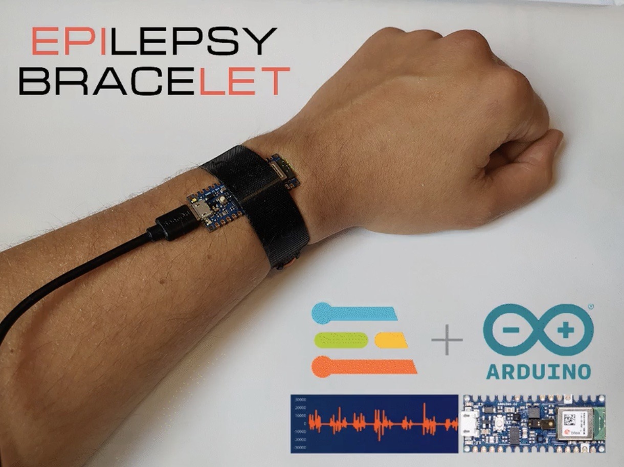 Epilet is a tinyMLpowered bracelet for detecting epileptic seizures