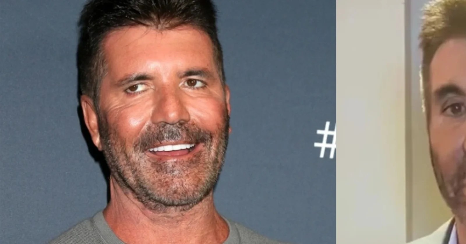 Fans Express Concern Over Simon Cowell’s Unrecognizable Appearance