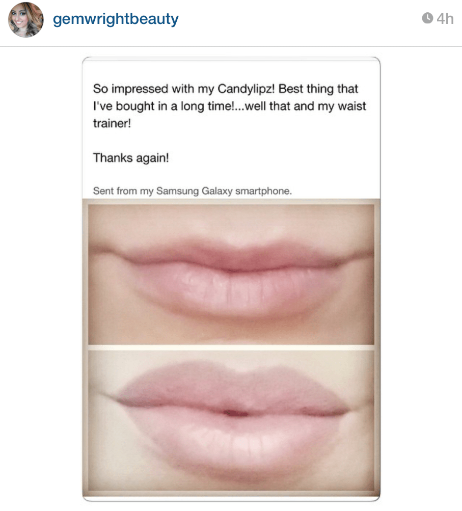 CandyLipz Lip Plumping Reviews Testimonials 1 How Long
