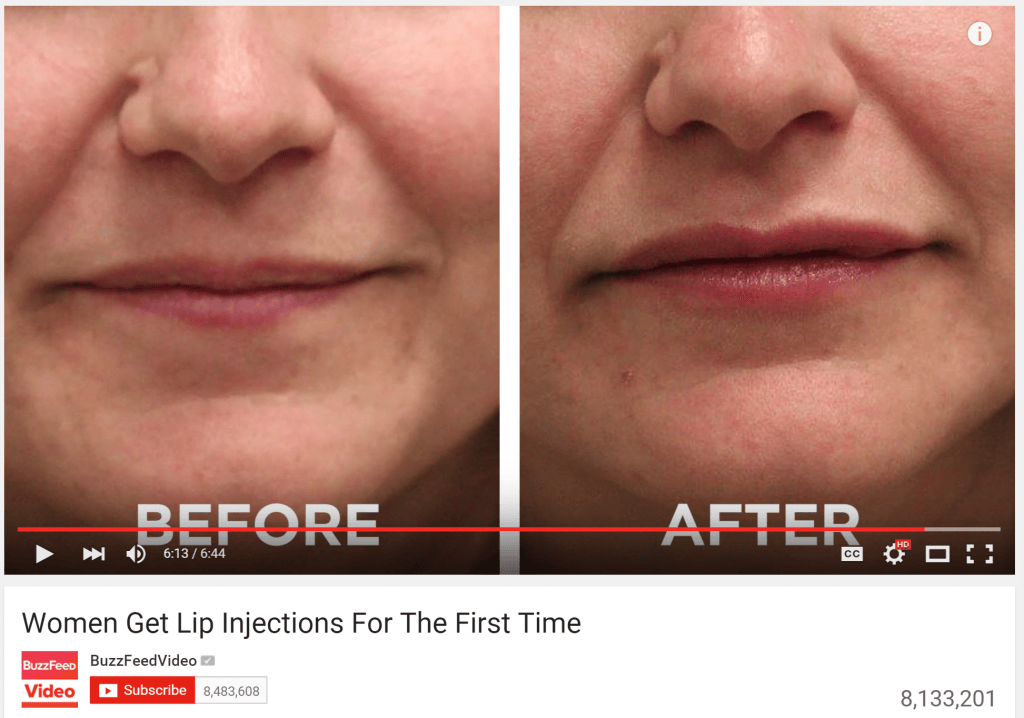 How to plump your pucker safely
