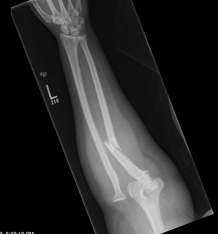 Xray Vision My Arm Looks Funny.... The Original Kings of County