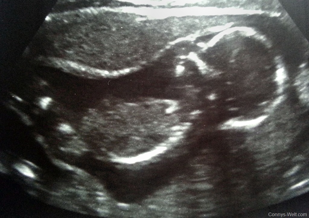 17. SSW meine Babys haben Schluckauf Connys Weblog Blog einer