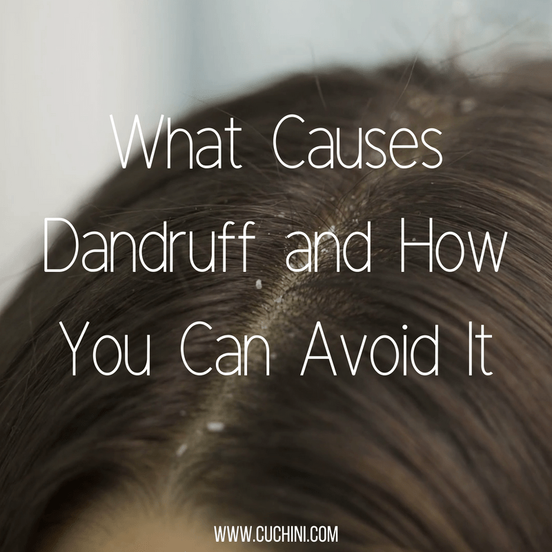What Causes Dandruff and How Can You Avoid It Cuchini Blog What Causes Dandruff and How Can You Avoid It Cuchini Blog