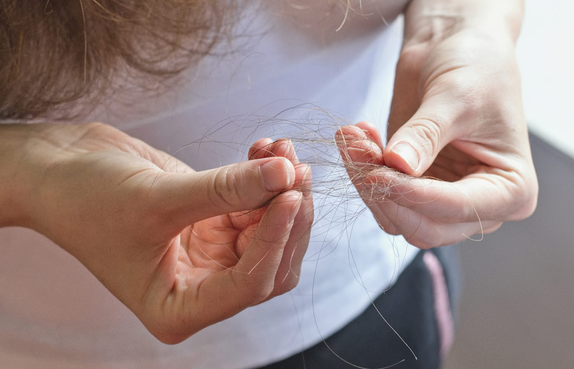 Why Do I Pull Out My Hair? Living With Trichotillomania