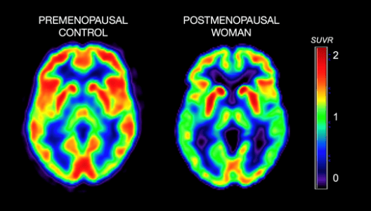 The Xx Brain The Groundbreaking Science Empowering.