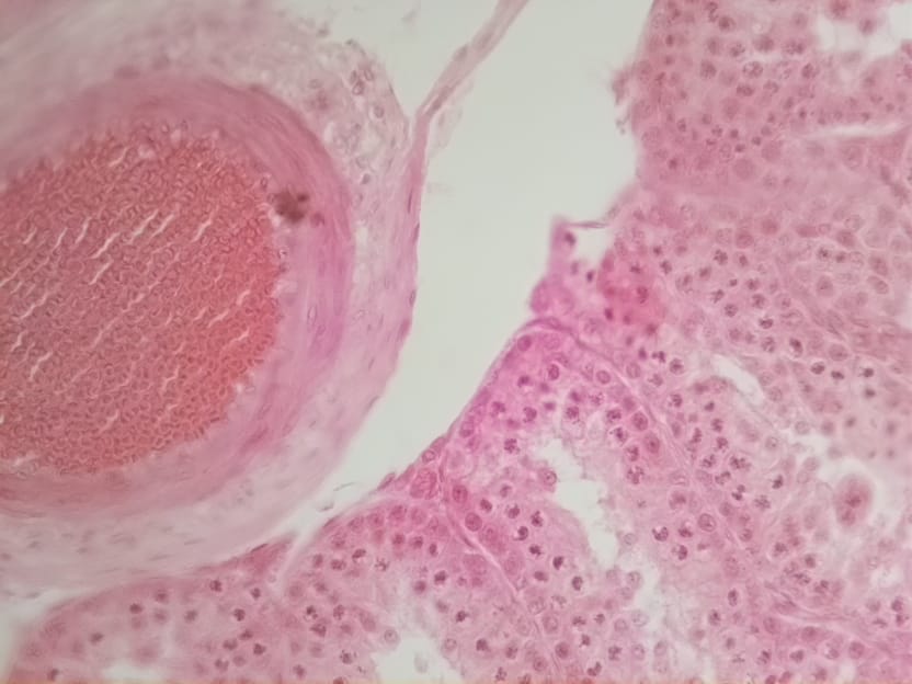 Spotlight Building an OpenFlexure Microscope