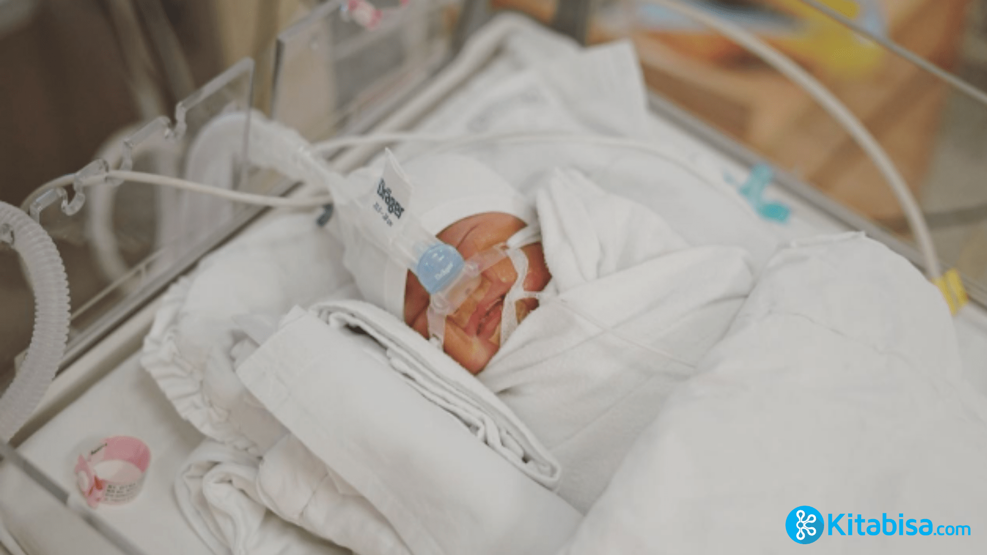 Kelahiran Bayi Prematur Penyebab, Komplikasi, dan Penanganan