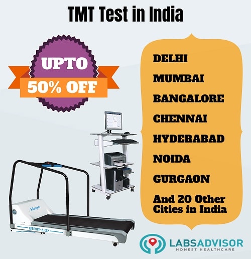TMT Test View Price, Preparation & Procedure on
