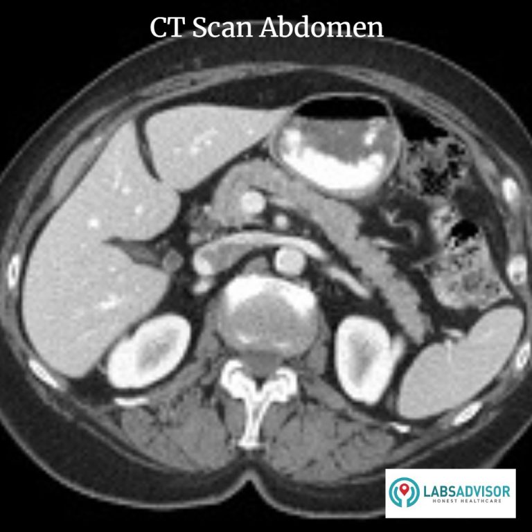 CT Scan Cost View Labs, Compare Prices & Get Up to 50