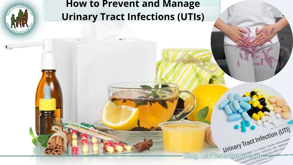 How to Prevent and Manage Urinary Tract Infections (UTIs) Lab Tests