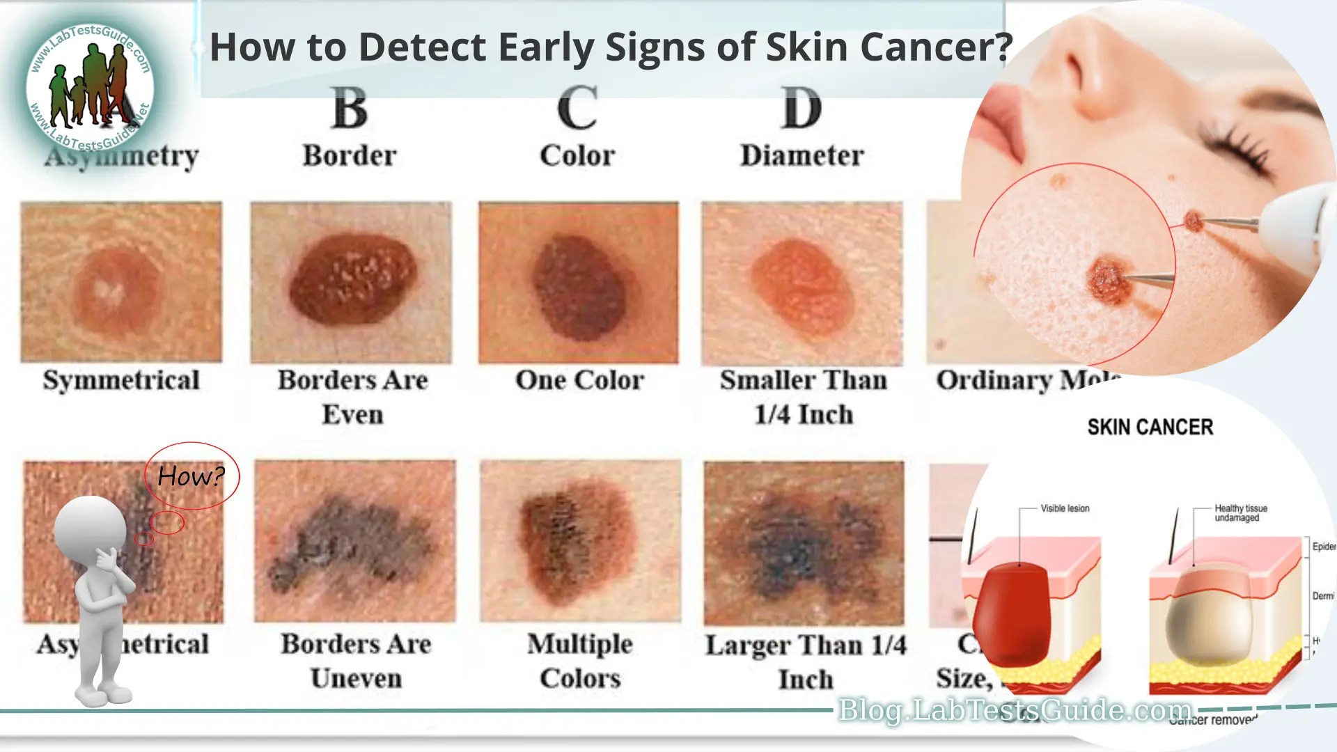 How to Detect Early Signs of Skin Cancer Lab Tests Guide Blog