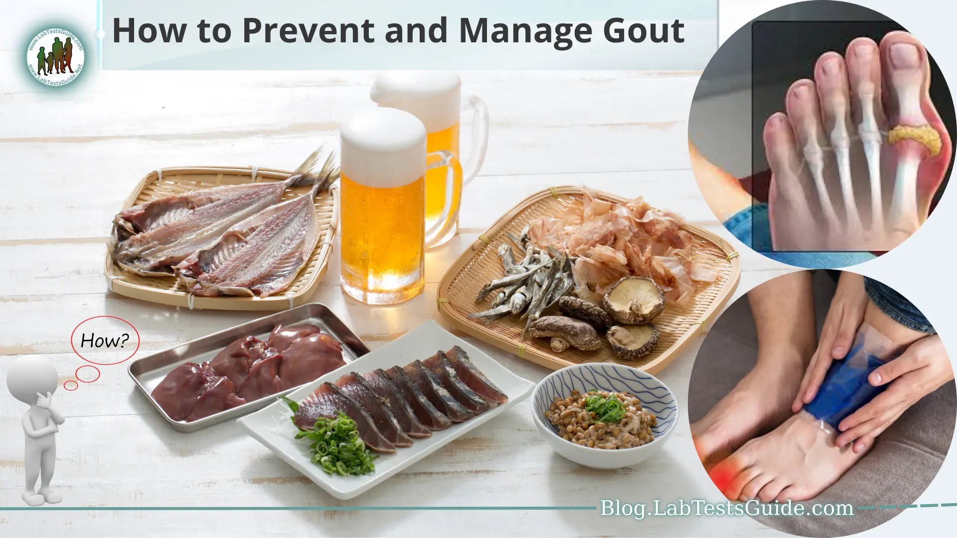 How to Prevent and Manage Gout? Lab Tests Guide Blog