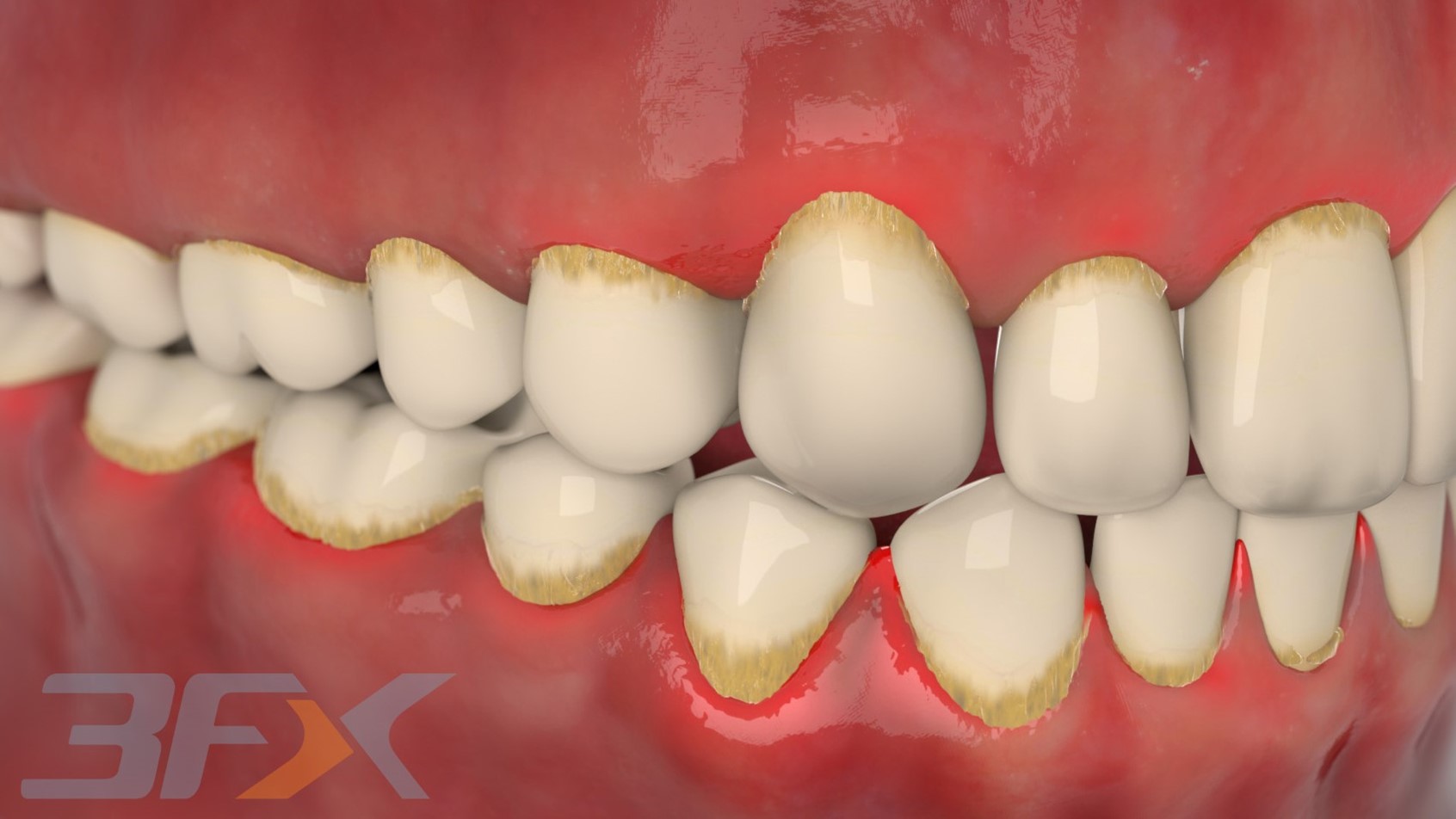 Specialty Feature Dentistry Artists' Blogs Medical Illustration