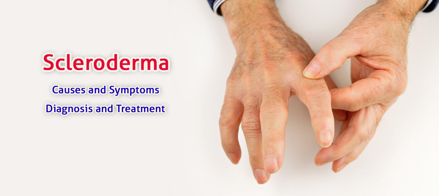 Scleroderma Causes, Symptoms, Diagnosis and Treatment MedPlusMart