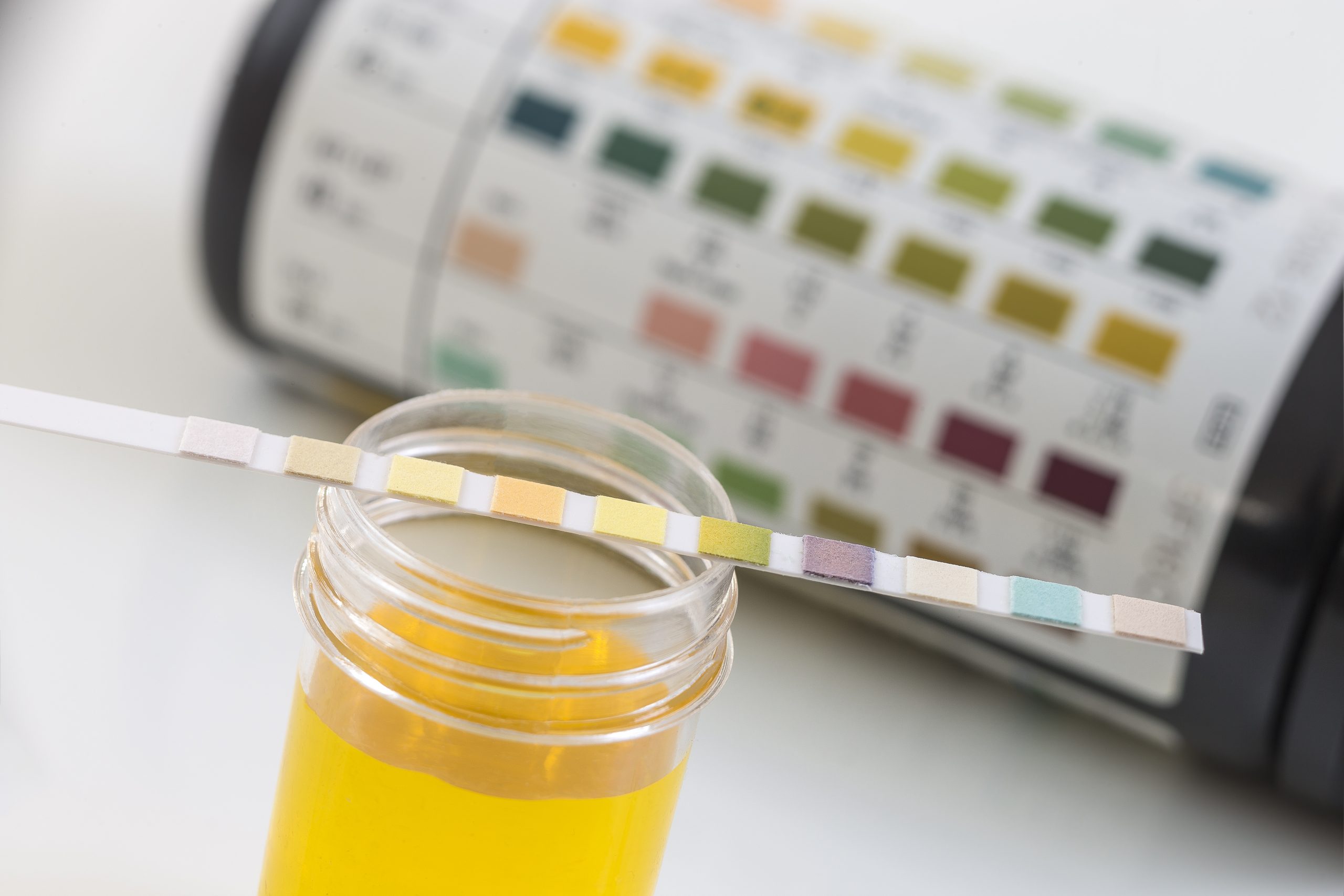 La importancia del pH para equilibrar el organismo Blog de Naturlíder