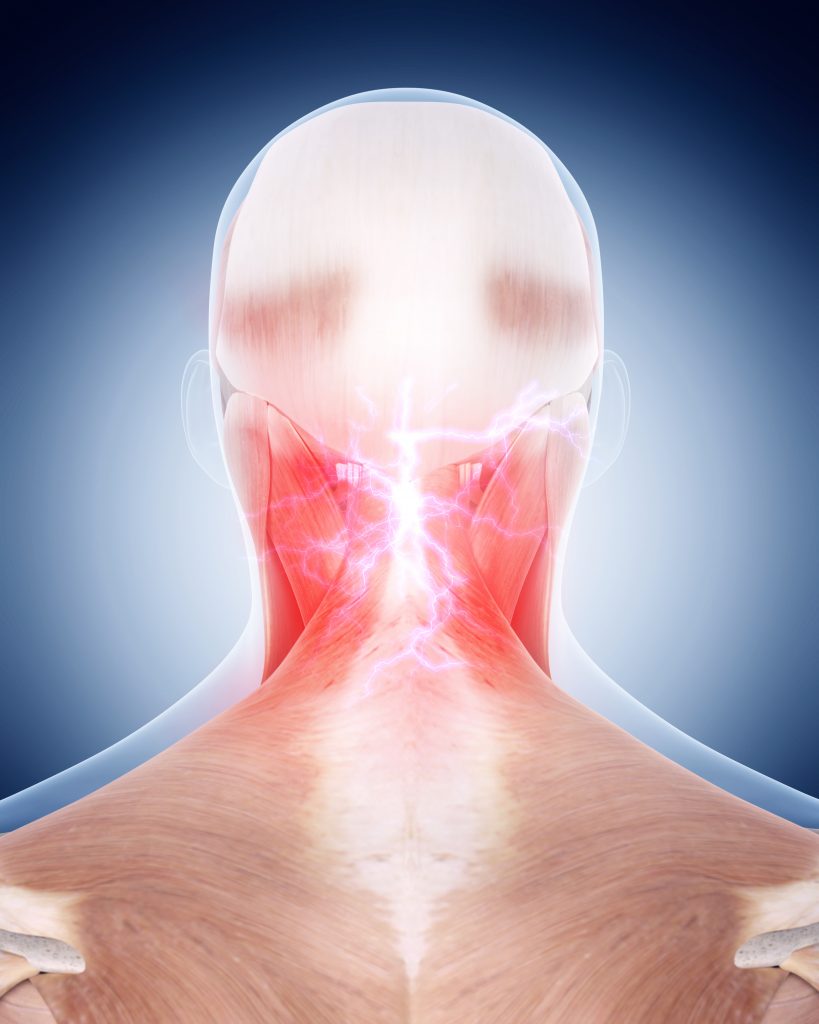 Why Am I Sore After Massage? The Real Answers OSIM NZ Blog