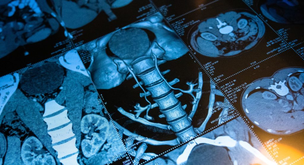 CT Scan 5 Facts to Help You Prepare for Your Exam UVA Radiology