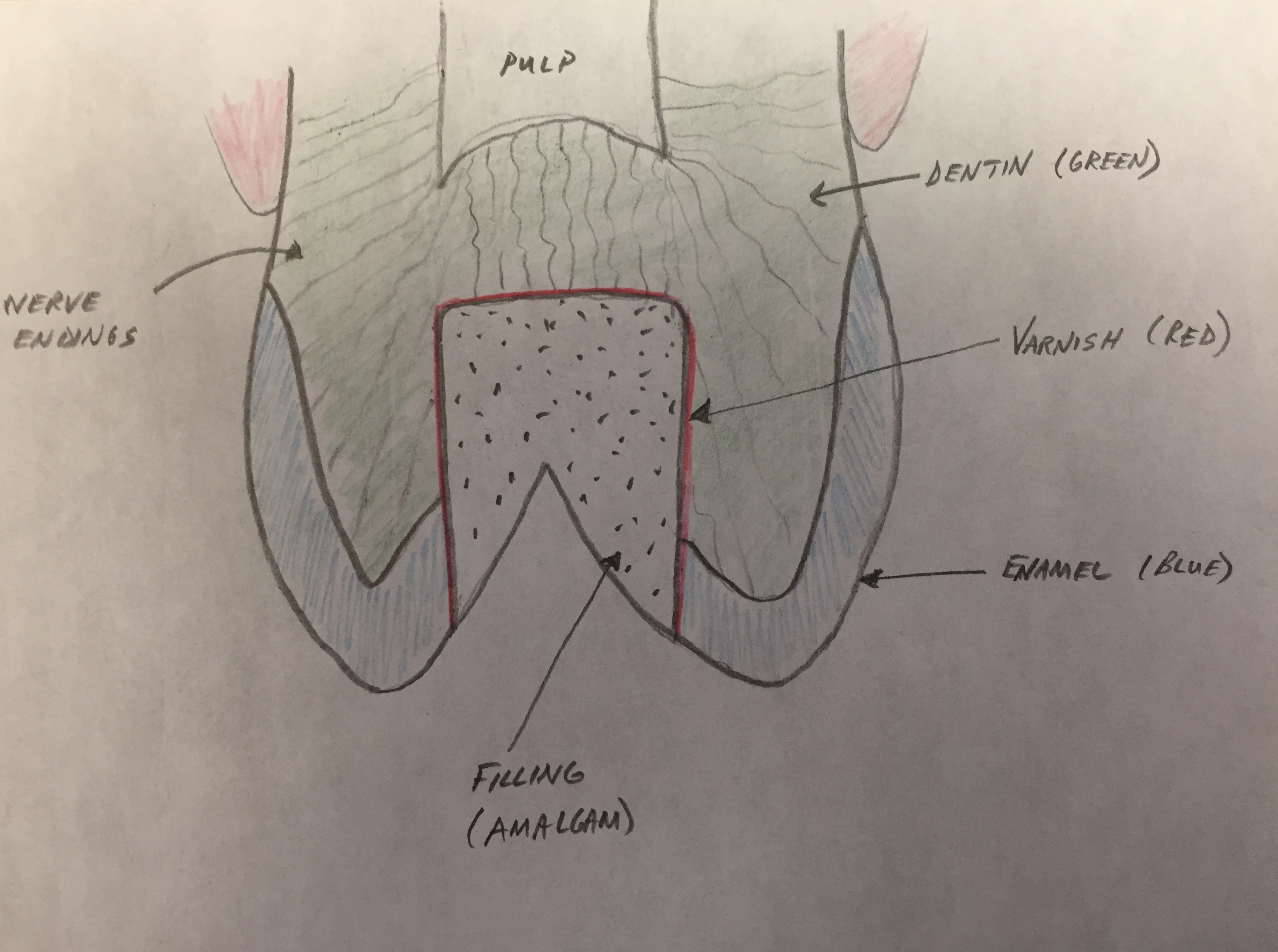 Are My Fillings Leaking?